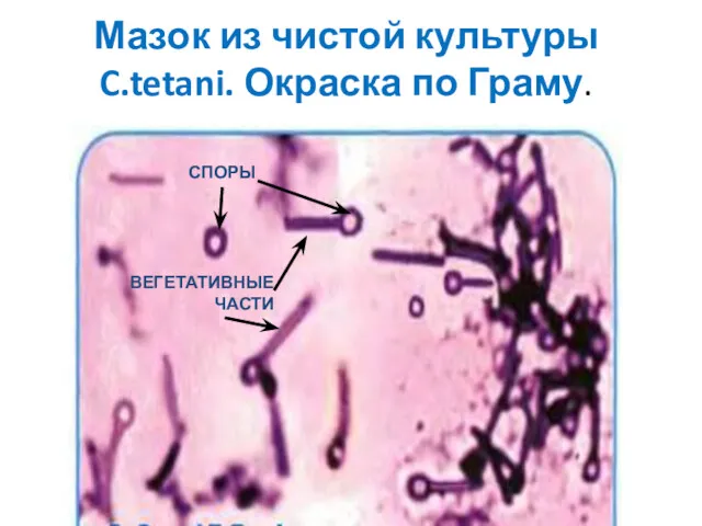 Мазок из чистой культуры C.tetani. Окраска по Граму. СПОРЫ ВЕГЕТАТИВНЫЕ ЧАСТИ