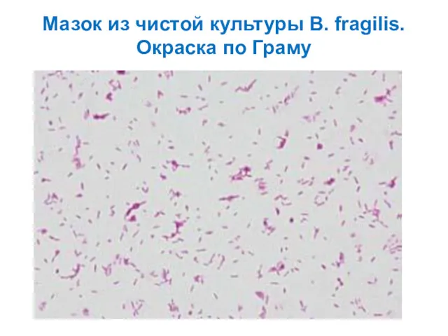 Мазок из чистой культуры B. fragilis. Окраска по Граму