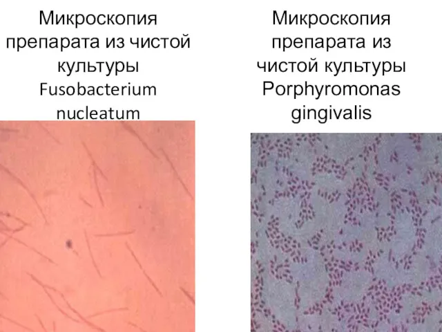 Микроскопия препарата из чистой культуры Fusobacterium nucleatum Микроскопия препарата из чистой культуры Porphyromonas gingivalis