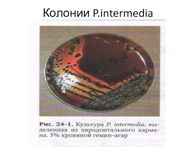 Колонии P.intermedia