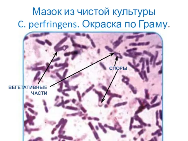 Мазок из чистой культуры C. perfringens. Окраска по Граму. СПОРЫ ВЕГЕТАТИВНЫЕ ЧАСТИ