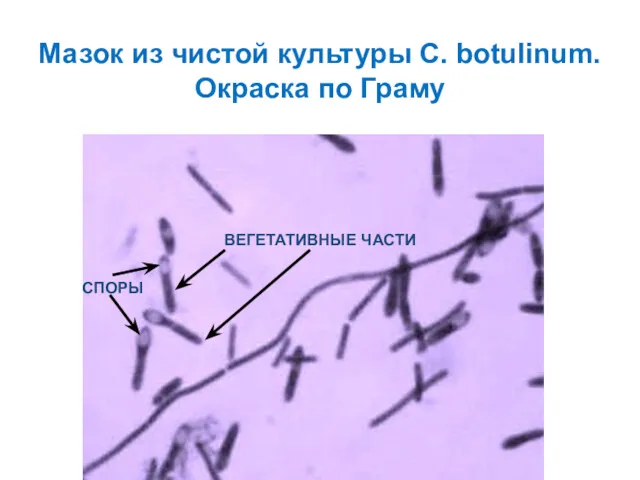 Мазок из чистой культуры C. botulinum. Окраска по Граму СПОРЫ ВЕГЕТАТИВНЫЕ ЧАСТИ