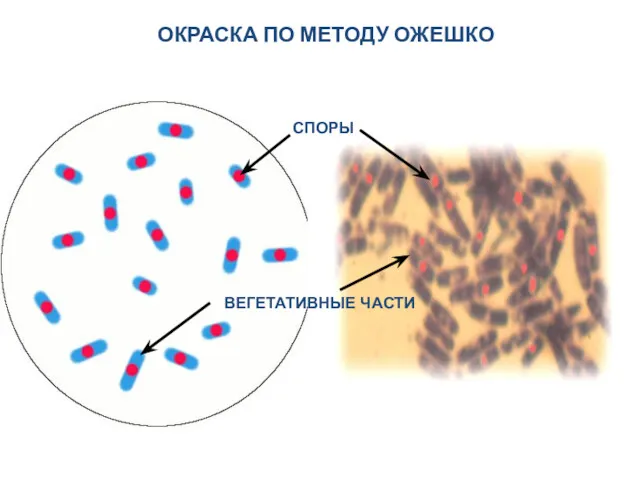 ОКРАСКА ПО МЕТОДУ ОЖЕШКО СПОРЫ ВЕГЕТАТИВНЫЕ ЧАСТИ