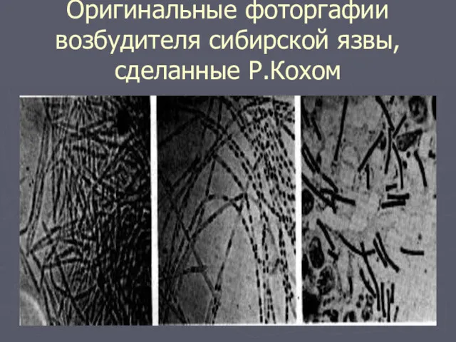 Оригинальные фоторгафии возбудителя сибирской язвы, сделанные Р.Кохом