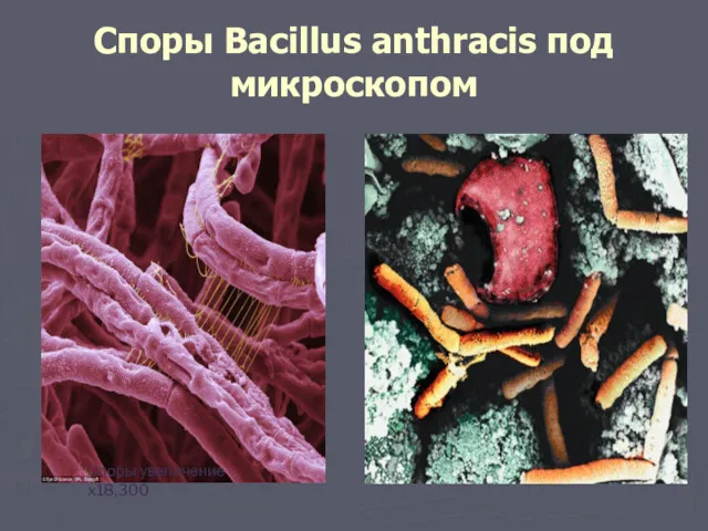 Споры Вacillus anthracis под микроскопом Споры увеличение x18,300