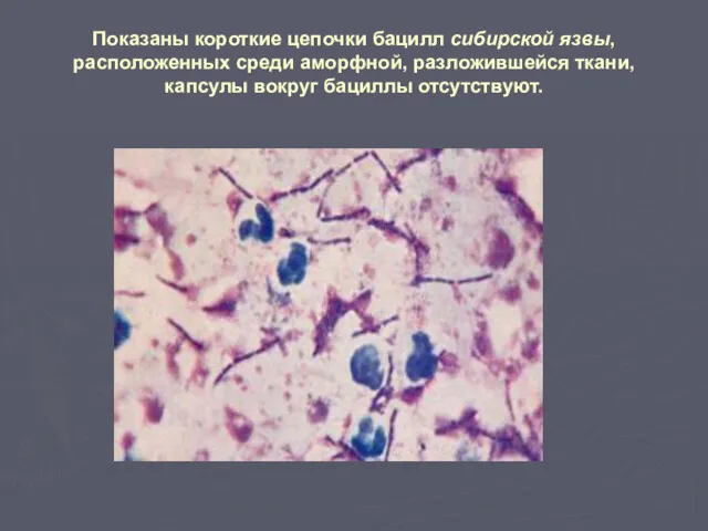 Показаны короткие цепочки бацилл сибирской язвы, расположенных среди аморфной, разложившейся ткани, капсулы вокруг бациллы отсутствуют.
