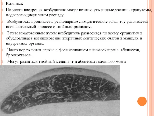 Клиника: На месте внедрения возбудителя могут возникнуть сапные узелки -