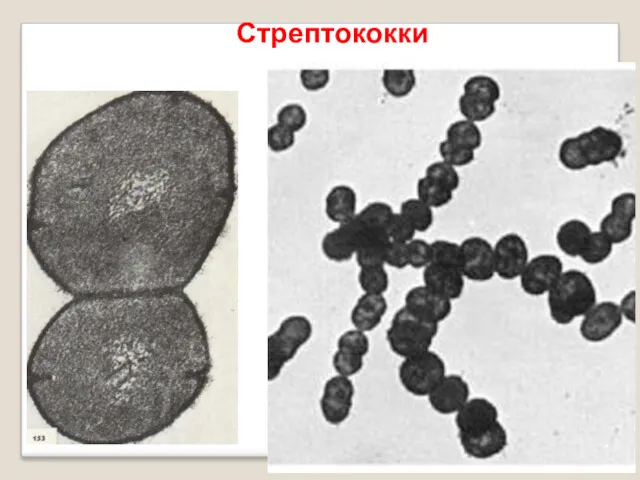 Стрептококки