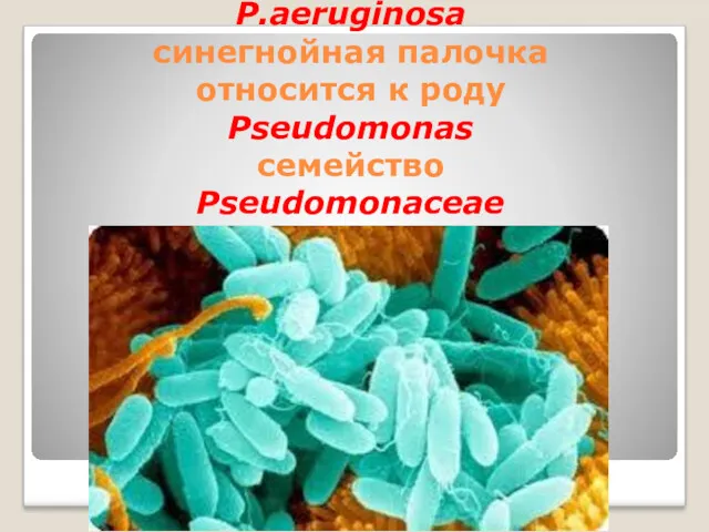 P.aeruginosa синегнойная палочка относится к роду Pseudomonas семейство Pseudomonaceae