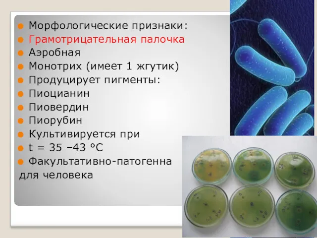 Морфологические признаки: Грамотрицательная палочка Аэробная Монотрих (имеет 1 жгутик) Продуцирует