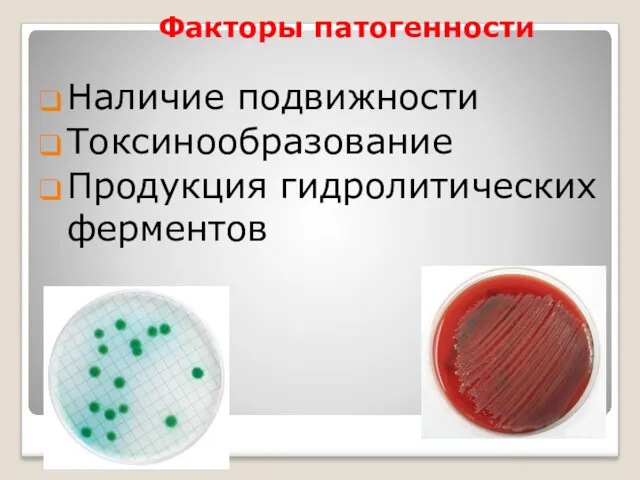 Факторы патогенности Наличие подвижности Токсинообразование Продукция гидролитических ферментов