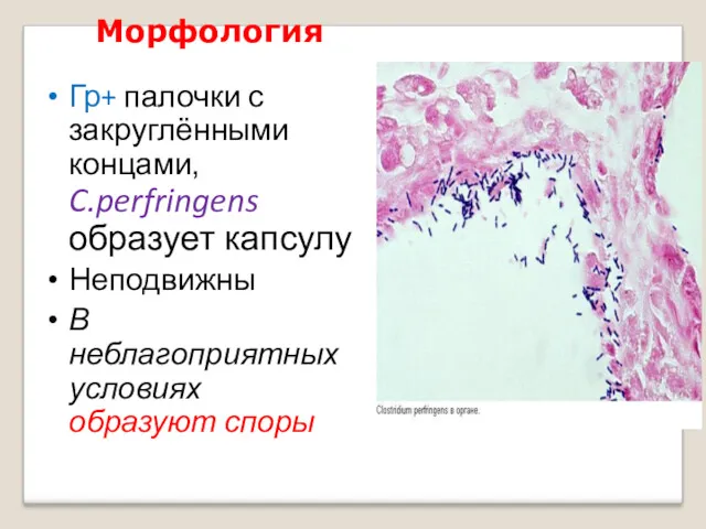 Морфология Гр+ палочки с закруглёнными концами, C.perfringens образует капсулу Неподвижны В неблагоприятных условиях образуют споры