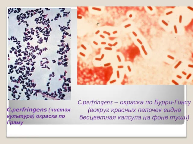 C.рerfringens (чистая культура) окраска по Граму C.рerfringens – окраска по