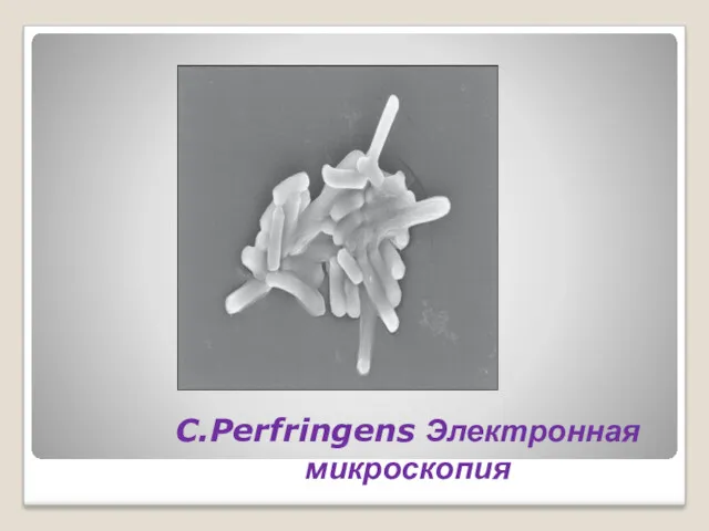 C.Perfringens Электронная микроскопия