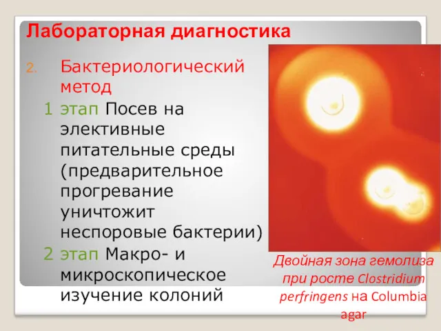 Лабораторная диагностика Бактериологический метод 1 этап Посев на элективные питательные