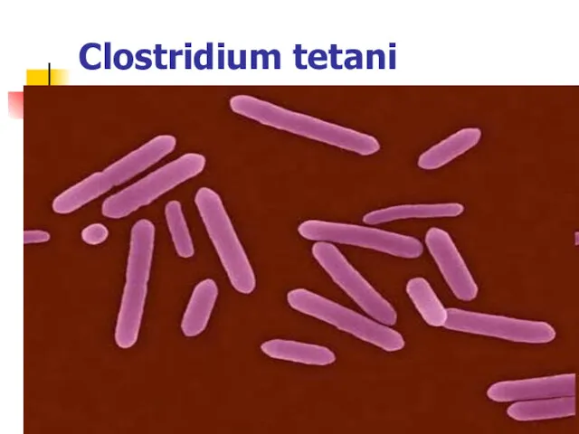 Clostridium tetani