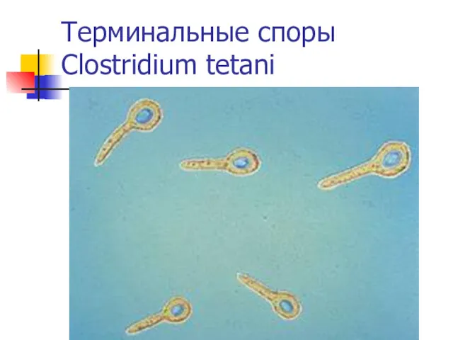 Терминальные споры Clostridium tetani