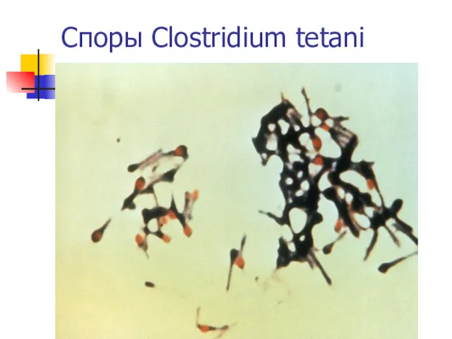 Споры Clostridium tetani