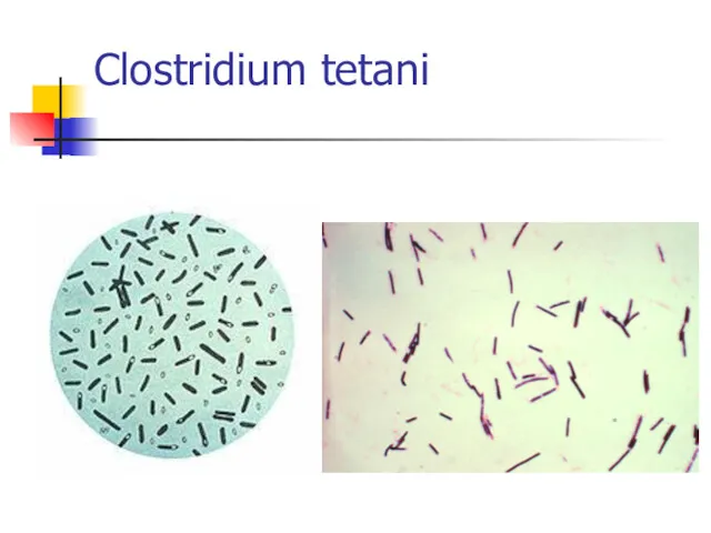 Clostridium tetani