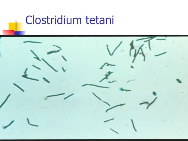 Clostridium tetani