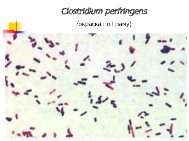 Clostridium perfringens (окраска по Граму)