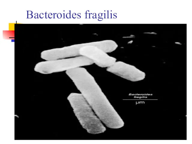 Bacteroides fragilis