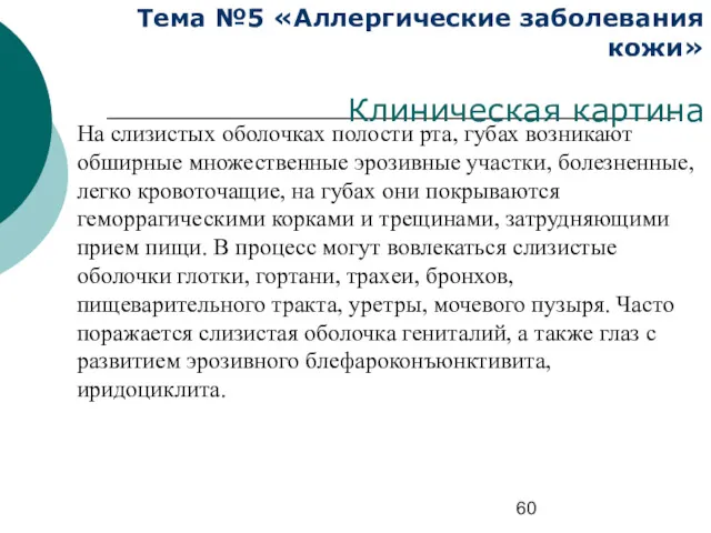 Тема №5 «Аллергические заболевания кожи» Клиническая картина На слизистых оболочках