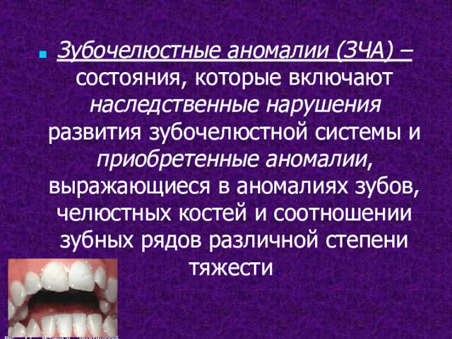 Зубочелюстные аномалии (ЗЧА) – состояния, которые включают наследственные нарушения развития