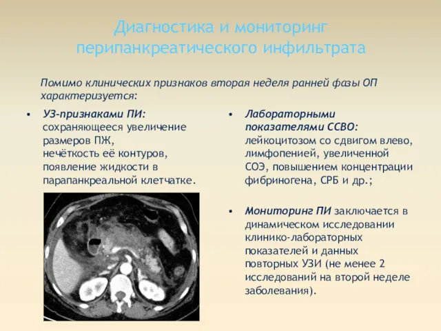 Диагностика и мониторинг перипанкреатического инфильтрата Помимо клинических признаков вторая неделя