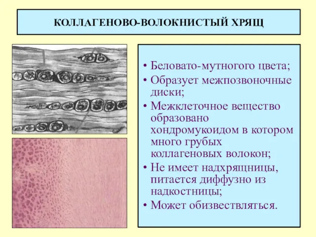 КОЛЛАГЕНОВО-ВОЛОКНИСТЫЙ ХРЯЩ Беловато-мутногого цвета; Образует межпозвоночные диски; Межклеточное вещество образовано хондромукоидом в котором
