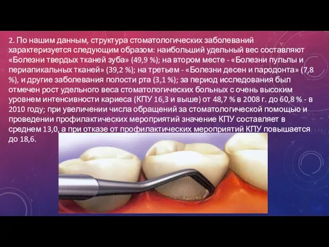 2. По нашим данным, структура стоматологических заболеваний характеризуется следующим образом: наибольший удельный вес