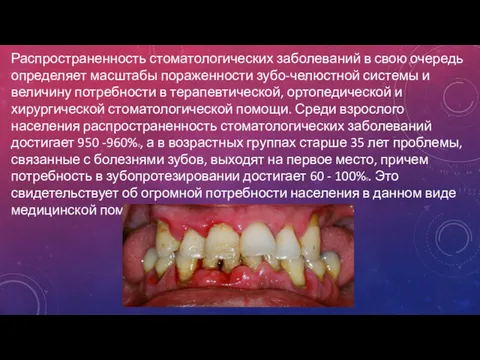 Распространенность стоматологических заболеваний в свою очередь определяет масштабы пораженности зубо-челюстной системы и величину