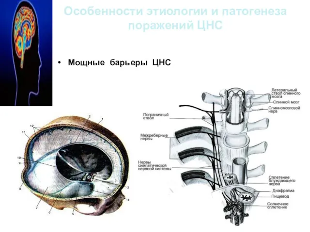 Особенности этиологии и патогенеза поражений ЦНС Мощные барьеры ЦНС