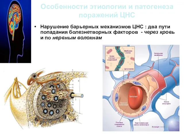 Особенности этиологии и патогенеза поражений ЦНС Нарушение барьерных механизмов ЦНС