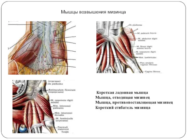 Мышцы возвышения мизинца Короткая ладонная мышца Мышца, отводящая мизинец Мышца, противопоставляющая мизинец Короткий сгибатель мизинца