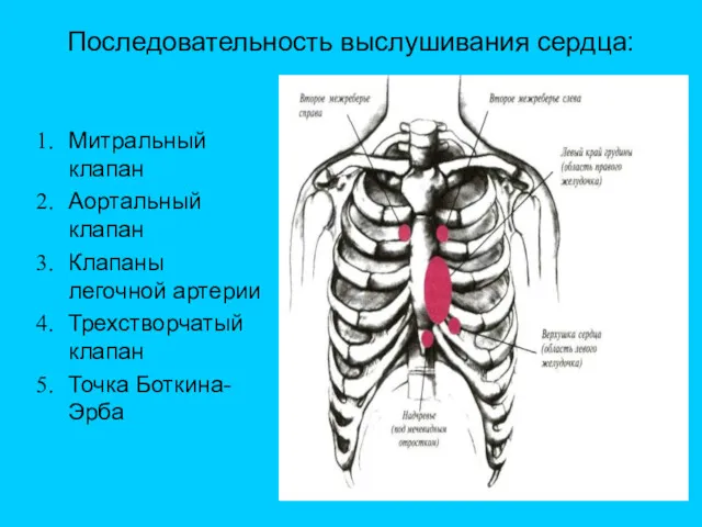 Последовательность выслушивания сердца: Митральный клапан Аортальный клапан Клапаны легочной артерии Трехстворчатый клапан Точка Боткина-Эрба