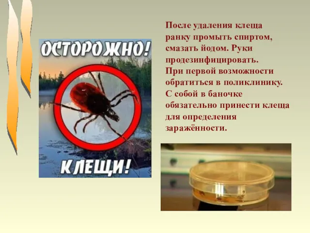 После удаления клеща ранку промыть спиртом, смазать йодом. Руки продезинфицировать. При первой возможности