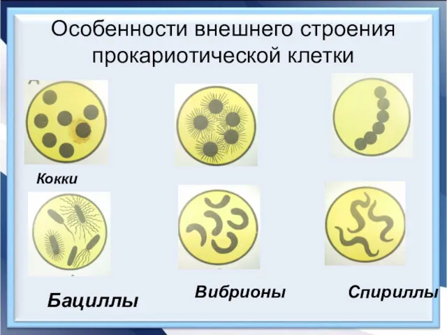 Особенности внешнего строения прокариотической клетки Кокки Бациллы Вибрионы Спириллы