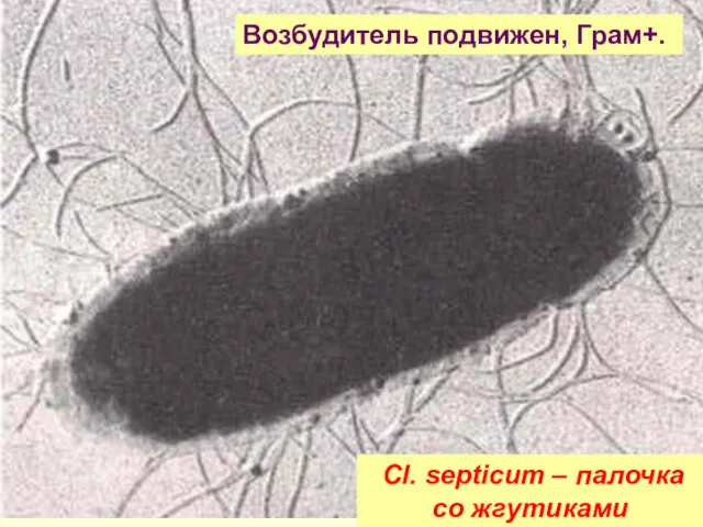 Cl. septicum – палочка со жгутиками Возбудитель подвижен, Грам+.