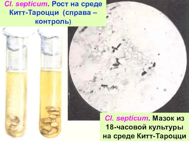 Cl. septicum. Мазок из 18-часовой культуры на среде Китт-Тароцци Cl.