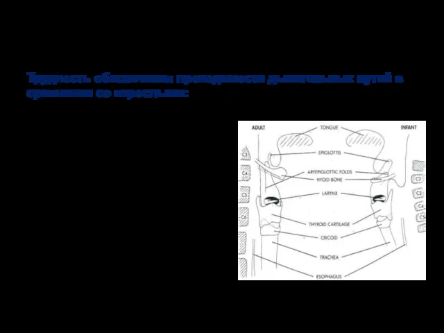 Возрастные особенности Трудность обеспечения проходимости дыхательных путей в сравнении со взрослыми: - большая