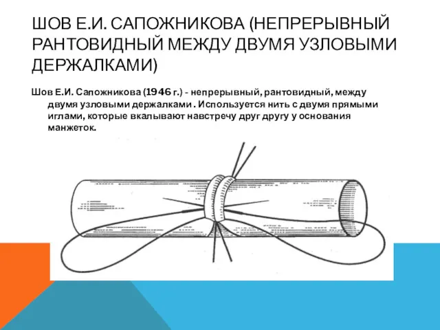 ШОВ Е.И. САПОЖНИКОВА (НЕПРЕРЫВНЫЙ РАНТОВИДНЫЙ МЕЖДУ ДВУМЯ УЗЛОВЫМИ ДЕРЖАЛКАМИ) Шов