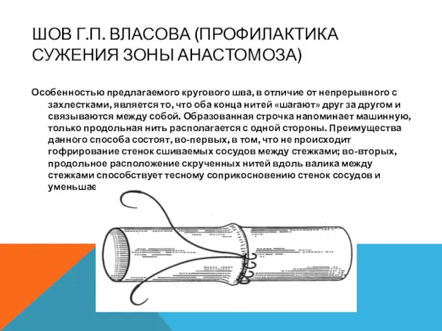 ШОВ Г.П. ВЛАСОВА (ПРОФИЛАКТИКА СУЖЕНИЯ ЗОНЫ АНАСТОМОЗА) Особенностью предлагаемого кругового