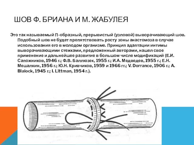 ШОВ Ф. БРИАНА И М. ЖАБУЛЕЯ Это так называемый П-образный,