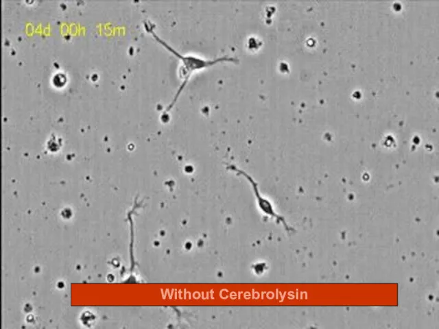 Without Cerebrolysin