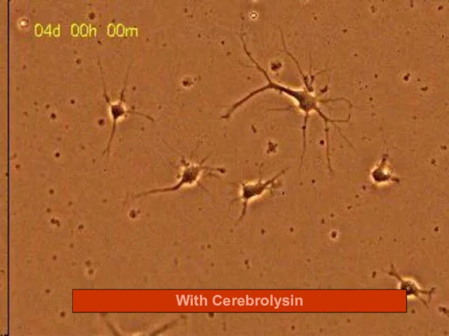 With Cerebrolysin