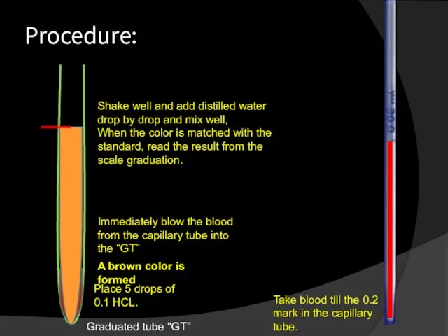 Procedure: Graduated tube “GT” Place 5 drops of 0.1 HCL. Take blood till