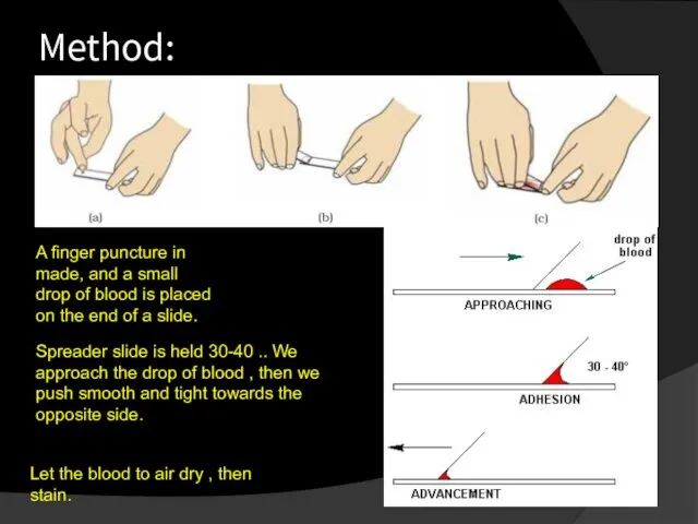Method: A finger puncture in made, and a small drop of blood is