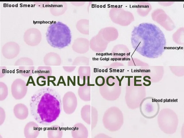 AGRANULOCYTES