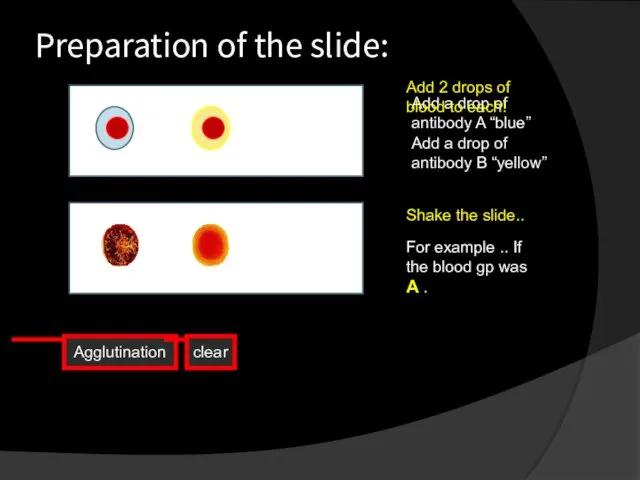 Preparation of the slide: Add a drop of antibody A “blue” Add a